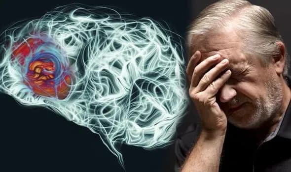 Alzheimer